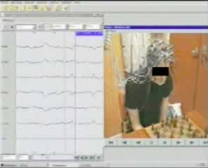 Chess-playing epilepsy: a case report with video-EEG and back averaging