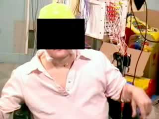 Senile myoclonic epilepsy in Down syndrome : a video and EEG presentation of two cases