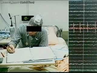 Self-induced stretch syncope of adolescence: a video-EEG documentation
