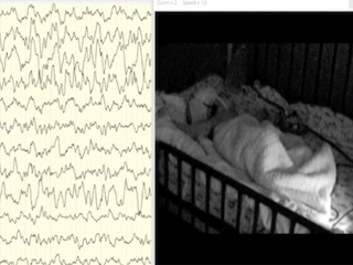 Ictal central sleep-related apnoea in Prader-Willi syndrome
