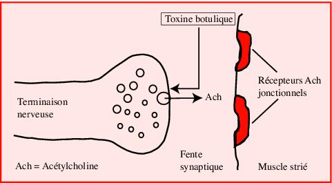 toxine botulinique