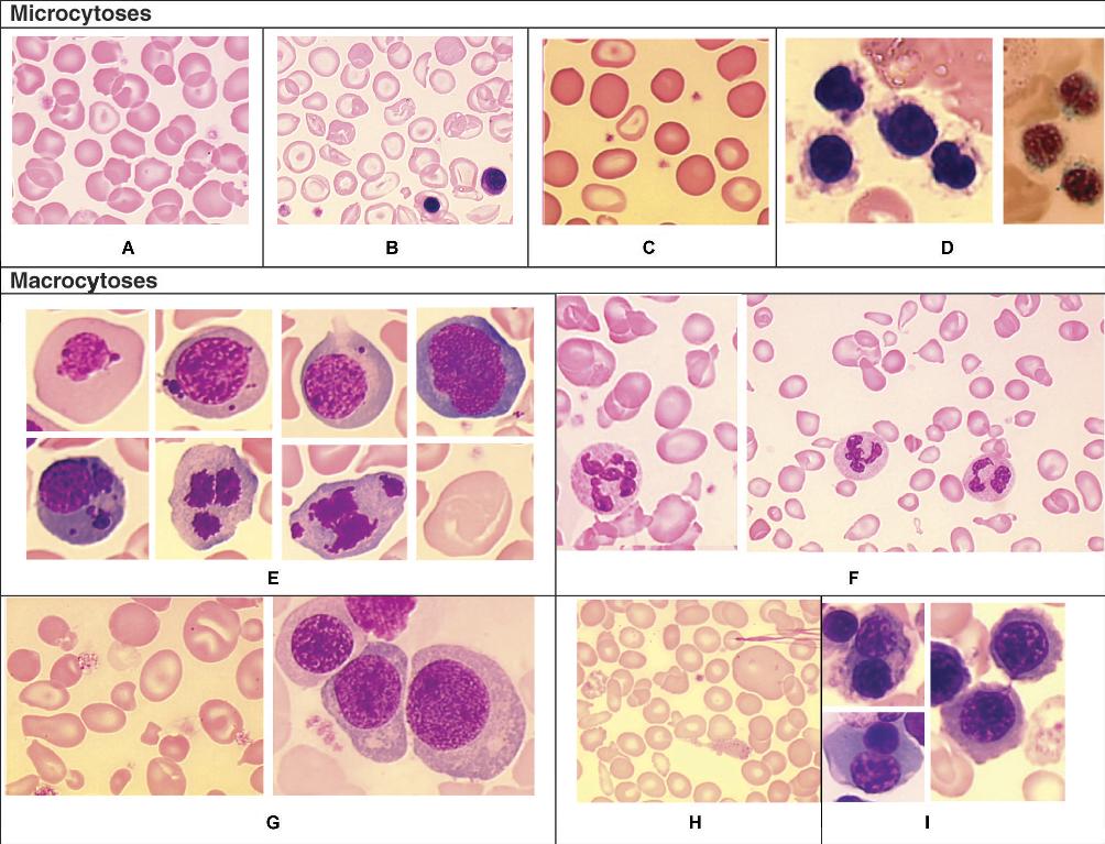John Libbey Eurotext Annales de Biologie Clinique Aspect cytologique normal et pathologique