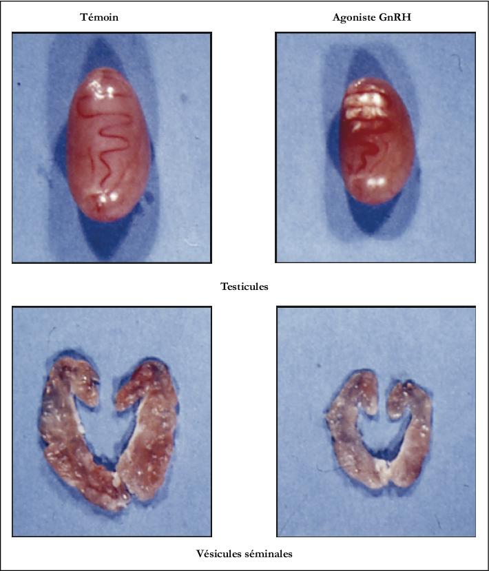 Prostatitis | nv-holders.hu