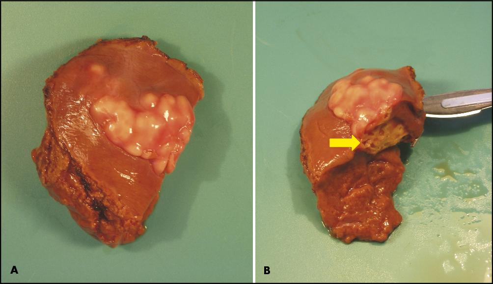 Dissertation aspects of echinococcosis
