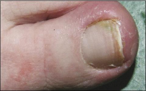 soigner le most cancers de l'estomac