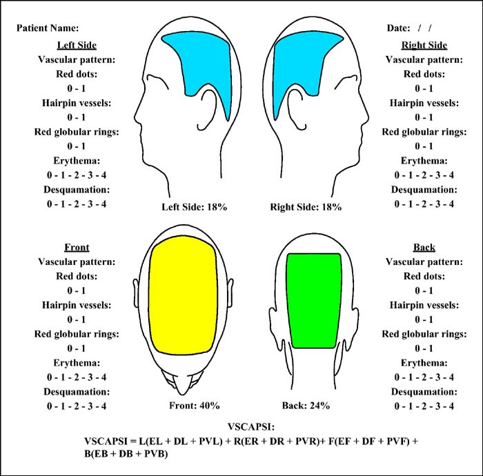 scale psoriasis severity