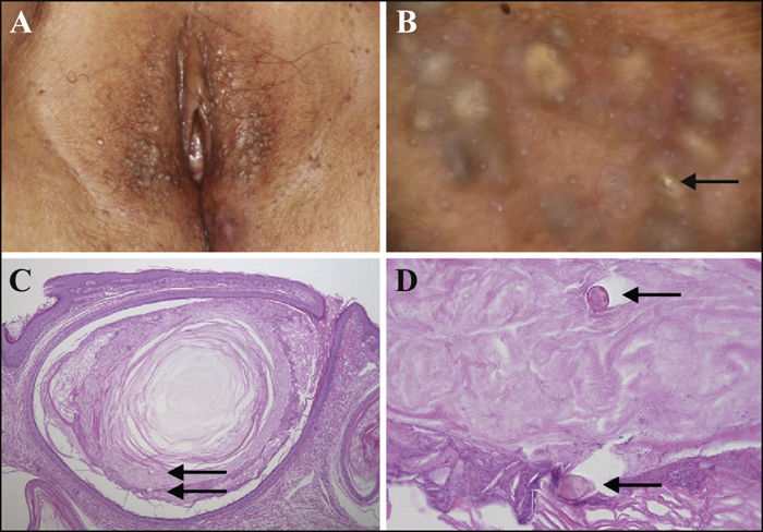 John Libbey Eurotext European Journal Of Dermatology Eruptive