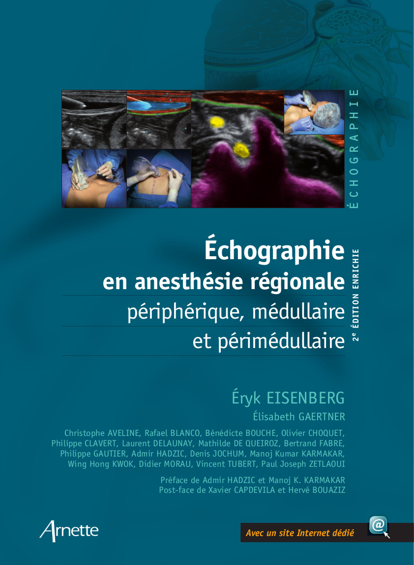 Ultrasound in regional anesthesia (2nd edition)