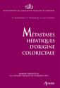 Liver metastases from colorectal cancer