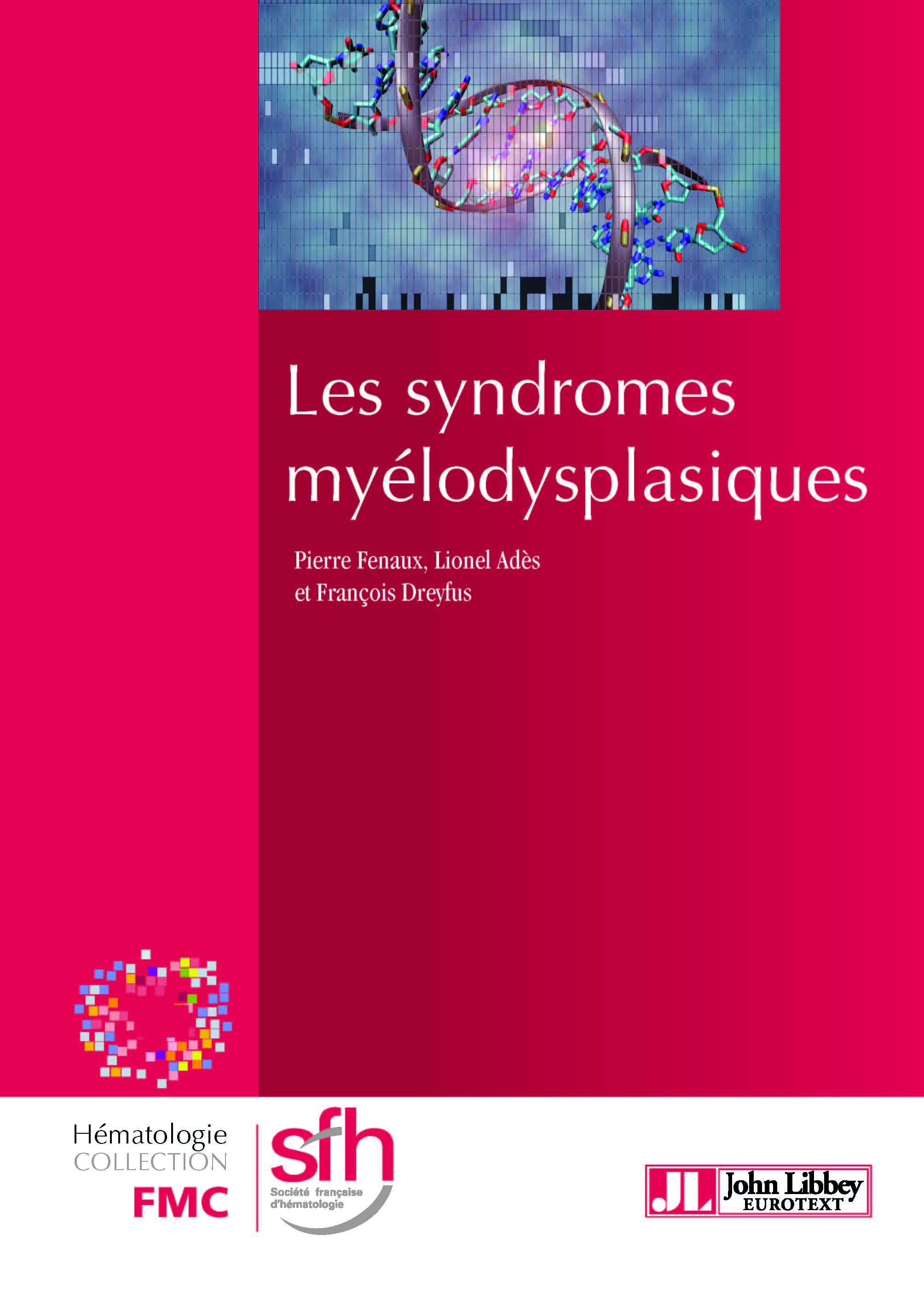 Les syndromes myélodysplasiques
