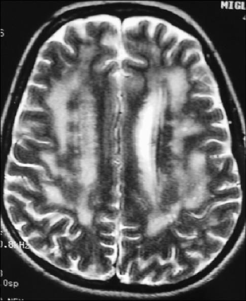 Mri Axial