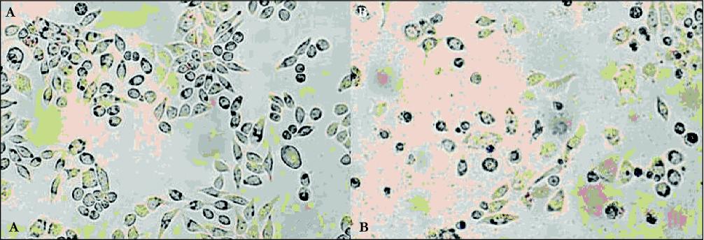 cancer cells under microscope. of hela cells under optic