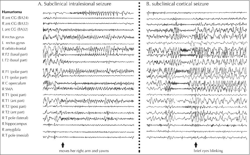  SMA: supplementary motor area; preC/postC: precentral/postcentral; 