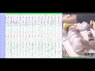 GEFS+ where focal seizures evolve from generalized spike wave: video-EEG study of two children