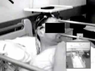 Ictal eructation: a case report