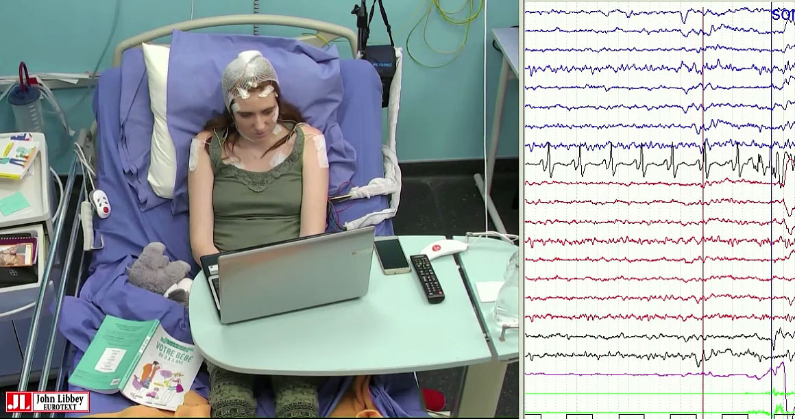 Musicogenic epilepsy with ictal asystole: a video-EEG case report