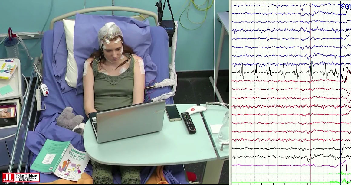 John Libbey Eurotext Epileptic Disorders Musicogenic Epilepsy With Ictal Asystole A Video Eeg Case Report