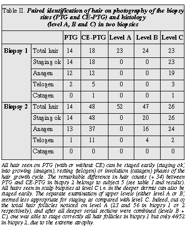 John Libbey Eurotext European Journal Of Dermatology Contrast Enhanced Phototrichogram Ce Ptg An Improved Non Invasive Technique For Measurement Of Scalp Hair Dynamics In Androgenetic Alopecia Validation Study With Histology After