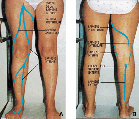 Veine saphène interne douleur