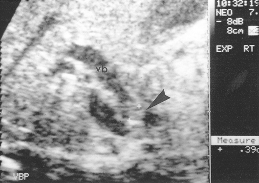 John Libbey Eurotext Medecine Therapeutique Pediatrie Diagnostic Des Cholestases Du Nouveau Ne John Libbey Eurotext Medecine Therapeutique Pediatrie Diagnostic Des Cholestases Du Nouveau Ne