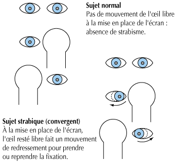 John Libbey Eurotext Medecine Therapeutique Pediatrie Diagnostic Et Traitement Du Strabisme Chez L Ancien Premature John Libbey Eurotext Medecine Therapeutique Pediatrie Diagnostic Et Traitement Du Strabisme Chez L Ancien Premature