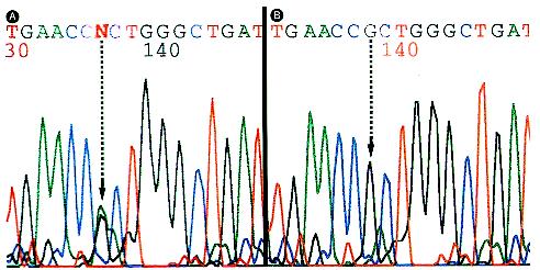 John Libbey Eurotext Hematologie Pathologie Moleculaire De L Anemie Sideroblastique John Libbey Eurotext Hematologie Pathologie Moleculaire De L Anemie Sideroblastique