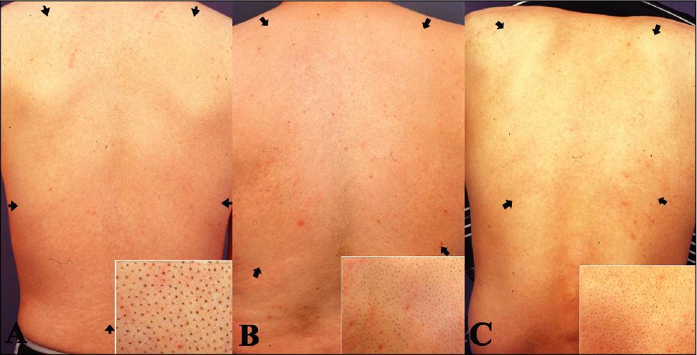 John Libbey Eurotext European Journal Of Dermatology The