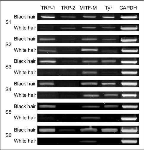 John Libbey Eurotext - European Journal of Dermatology - Changing expression of the genes related to human hair graying John Libbey Eurotext - European Journal of Dermatology - Changing expression of the genes related to human hair graying