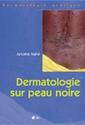 Dermatologie sur peau noire