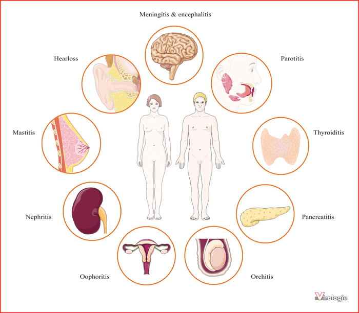 John Libbey Eurotext Virologie Mumps Virus A Comprehensive Review