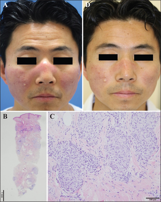 John Libbey Eurotext European Journal Of Dermatology