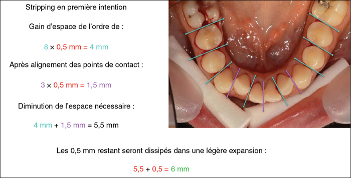 a et / and b Vues occlusales des arcades dentaires. Les 32 et 42 ont