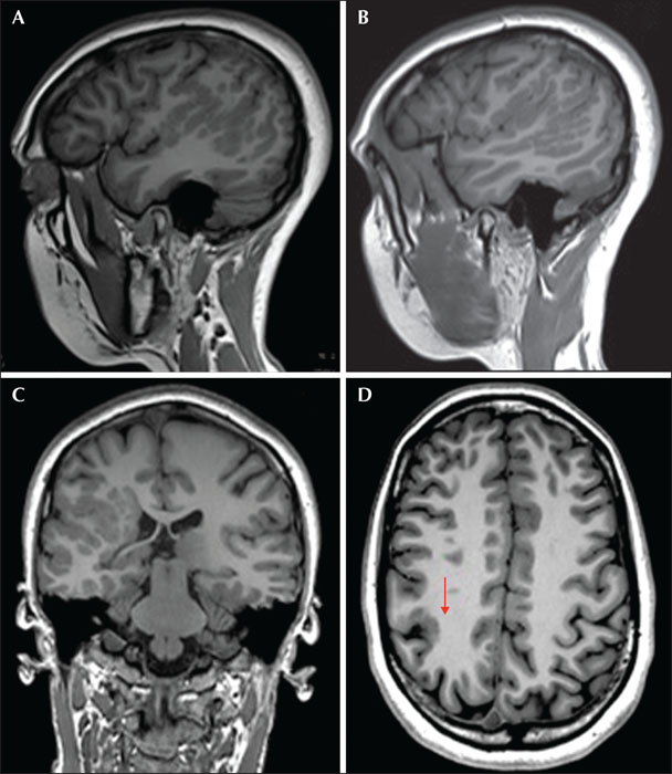 Ángel ALEDO-SERRANO, Neurologist / Epileptologist