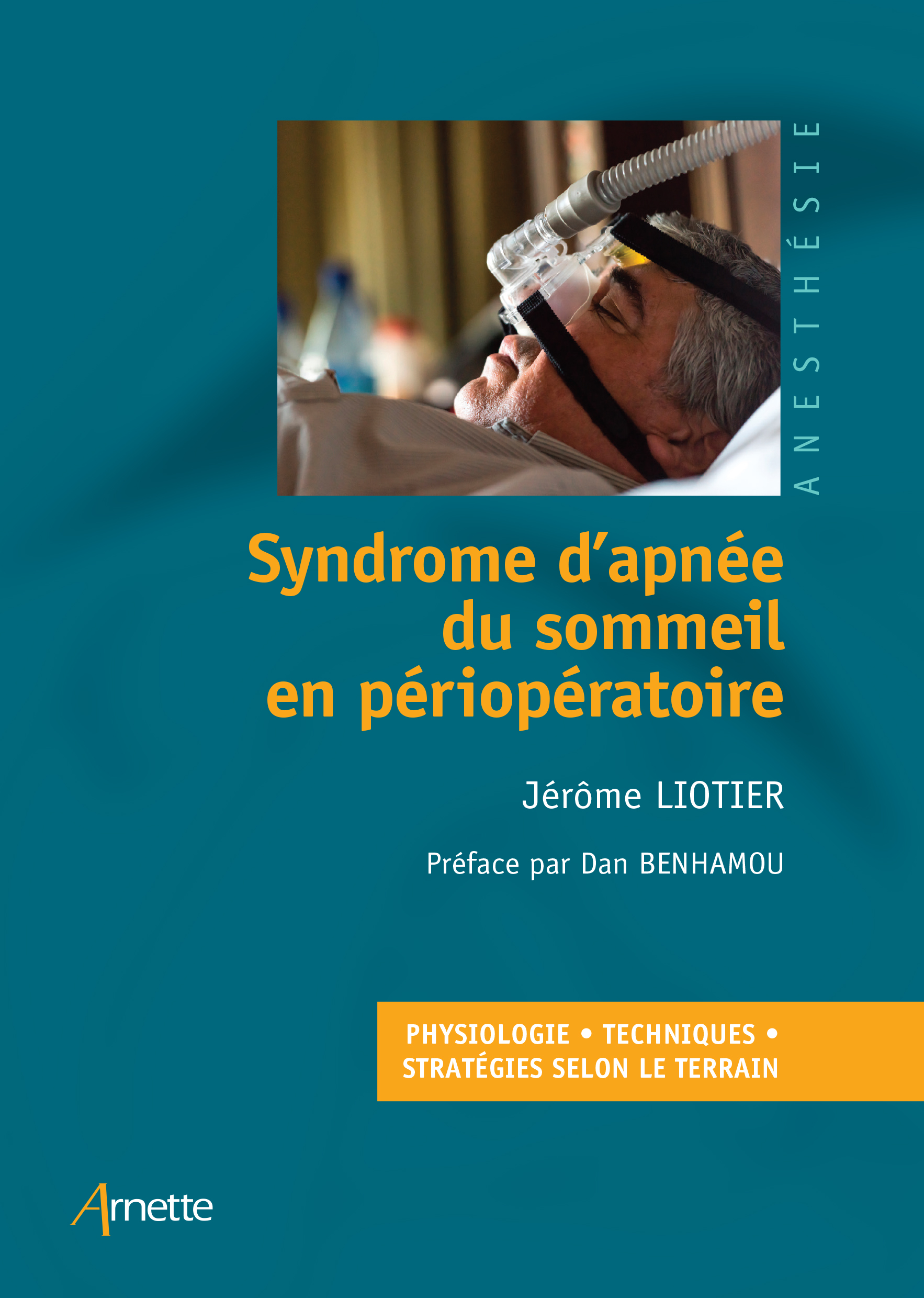 Syndrome d’apnée du sommeil en périopératoire