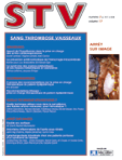 Sang Thrombose Vaisseaux