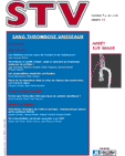 Sang Thrombose Vaisseaux