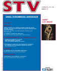 Sang Thrombose Vaisseaux