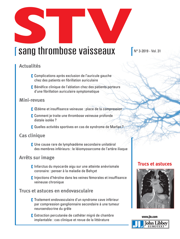 Sang Thrombose Vaisseaux